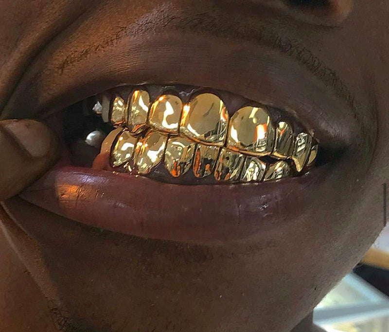 Custom Solid Gold Grillz