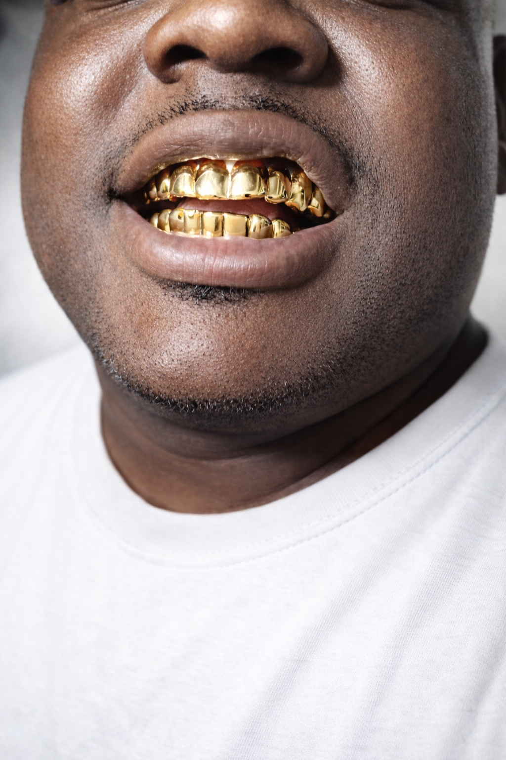 Custom Solid Gold Grillz