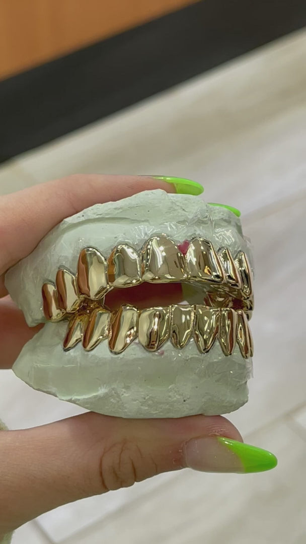 Custom Solid Gold Grillz
